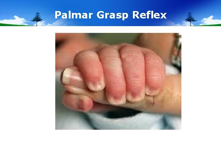 Palmar Grasp Reflex 