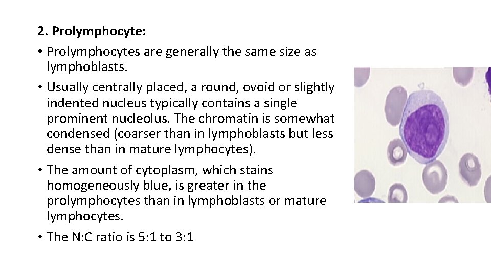 2. Prolymphocyte: • Prolymphocytes are generally the same size as lymphoblasts. • Usually centrally