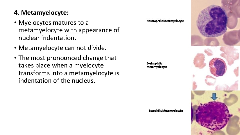 4. Metamyelocyte: • Myelocytes matures to a metamyelocyte with appearance of nuclear indentation. •