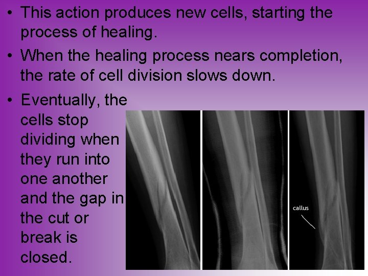  • This action produces new cells, starting the process of healing. • When