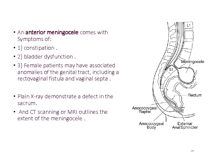  • An anterior meningocele comes with Symptoms of: • 1) constipation. • 2)