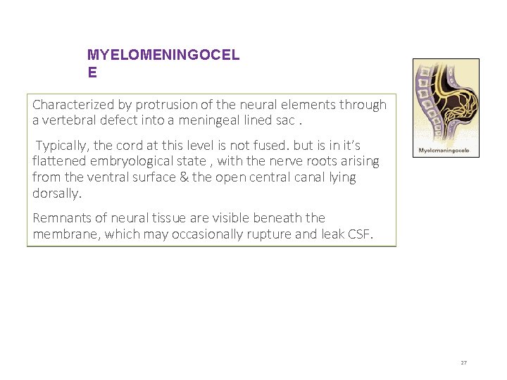 MYELOMENINGOCEL E Characterized by protrusion of the neural elements through a vertebral defect into