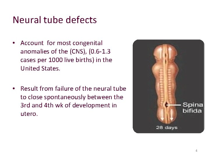 Neural tube defects • Account for most congenital anomalies of the (CNS), (0. 6