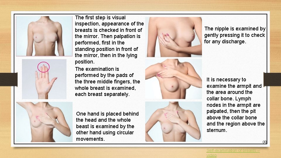 The first step is visual inspection, appearance of the breasts is checked in front
