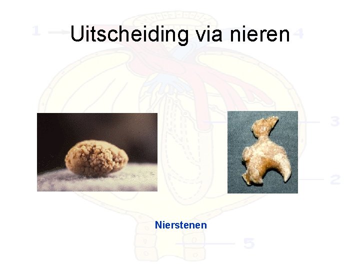 Uitscheiding via nieren Nierstenen 