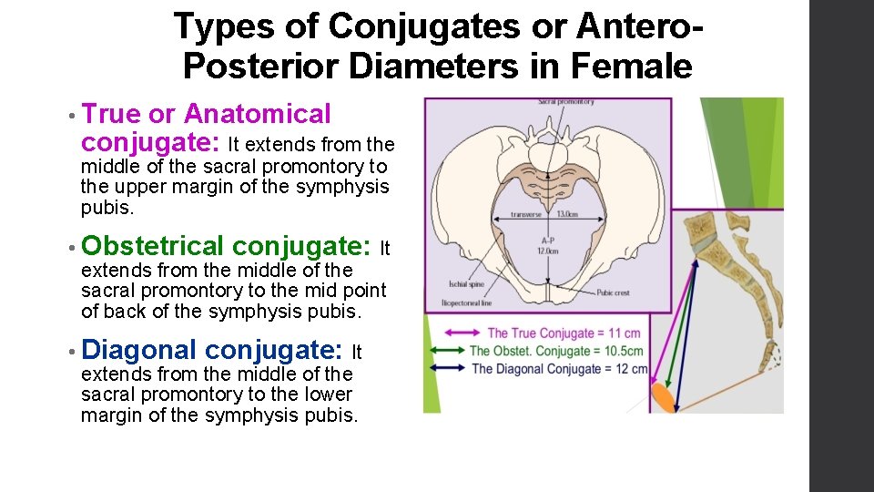 Types of Conjugates or Antero. Posterior Diameters in Female • True or Anatomical conjugate: