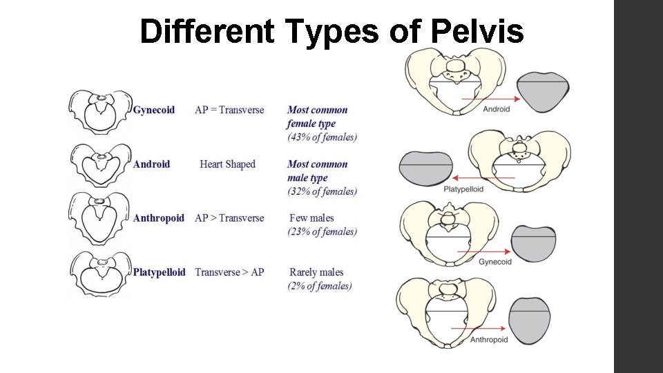 Different Types of Pelvis 