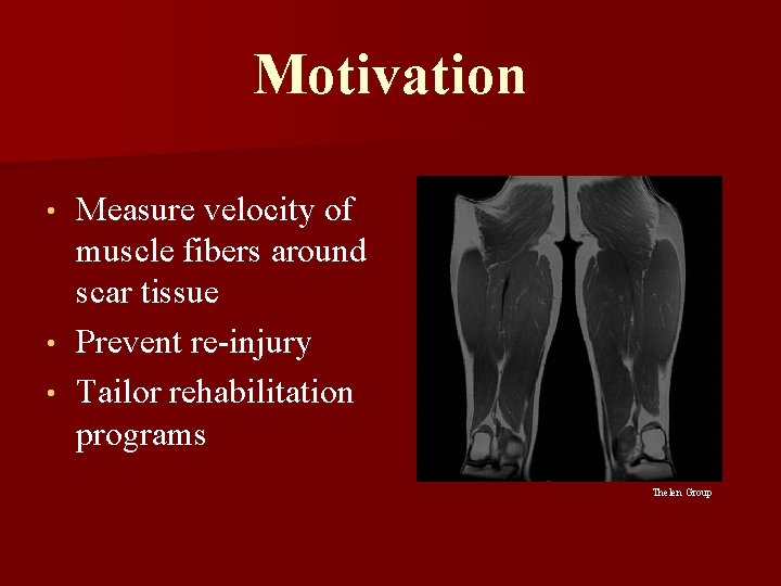 Motivation Measure velocity of muscle fibers around scar tissue • Prevent re-injury • Tailor