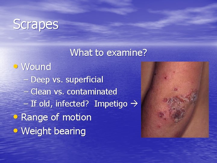 Scrapes • Wound What to examine? – Deep vs. superficial – Clean vs. contaminated