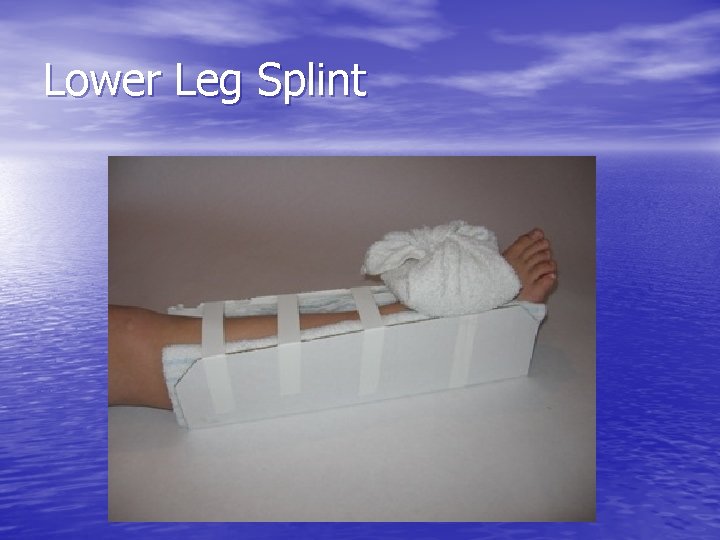 Emergency Splinting and Trauma First Aid Coburn H