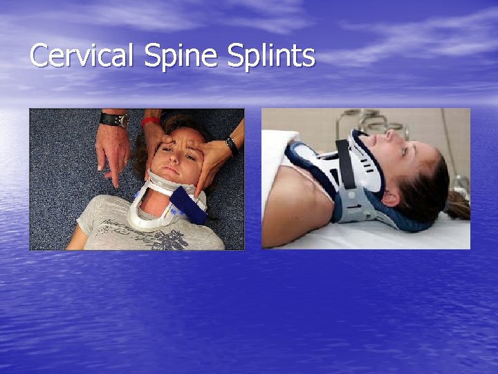 Cervical Spine Splints 