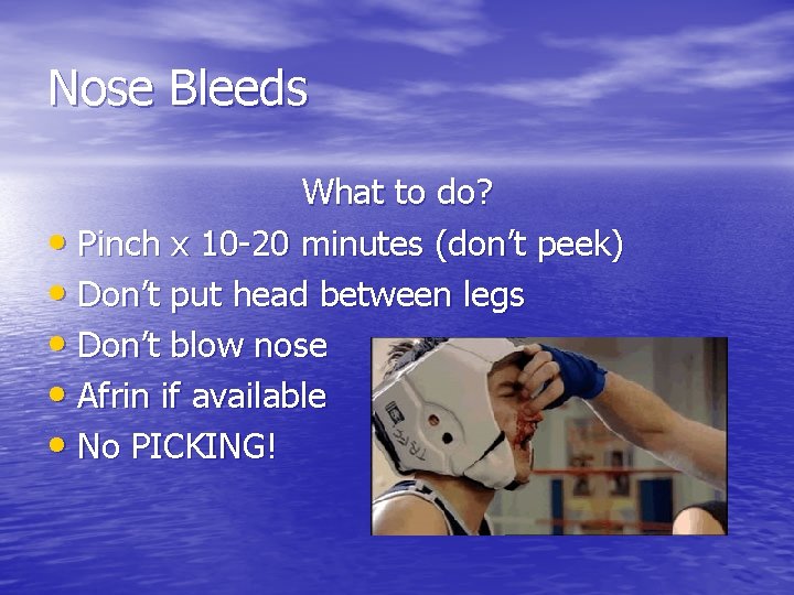 Nose Bleeds What to do? • Pinch x 10 -20 minutes (don’t peek) •
