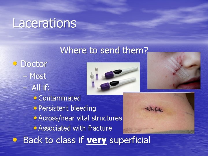 Lacerations • Doctor Where to send them? – Most – All if: • Contaminated