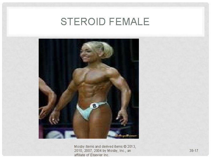STEROID FEMALE Mosby items and derived items © 2013, 2010, 2007, 2004 by Mosby, STEROID FEMALE Mosby items and derived items © 2013, 2010, 2007, 2004 by Mosby,