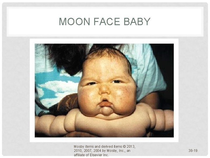 MOON FACE BABY Mosby items and derived items © 2013, 2010, 2007, 2004 by MOON FACE BABY Mosby items and derived items © 2013, 2010, 2007, 2004 by