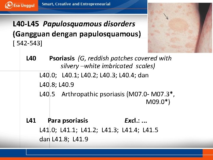 L 40 -L 45 Papulosquamous disorders (Gangguan dengan papulosquamous) [ 542 -543] L 40