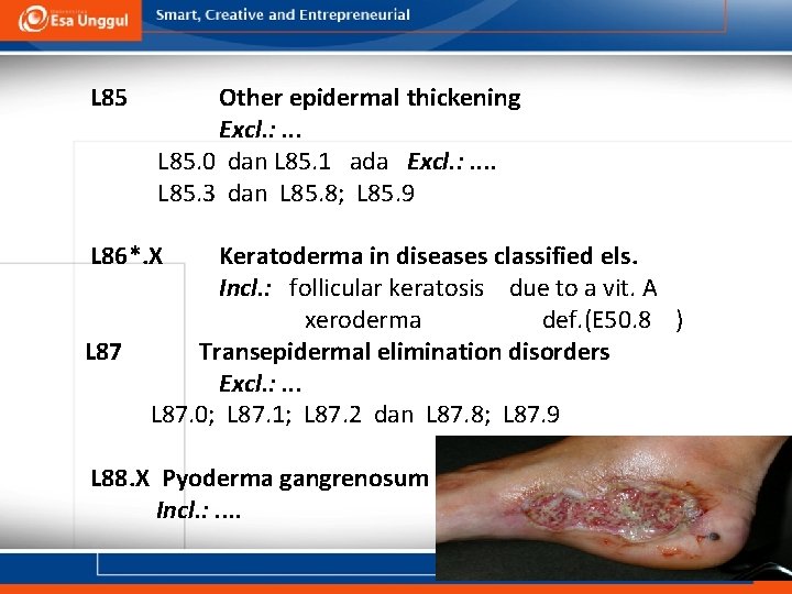 L 85 Other epidermal thickening Excl. : . . . L 85. 0 dan