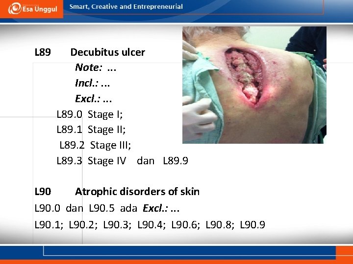L 89 Decubitus ulcer Note: . . . Incl. : . . . Excl.
