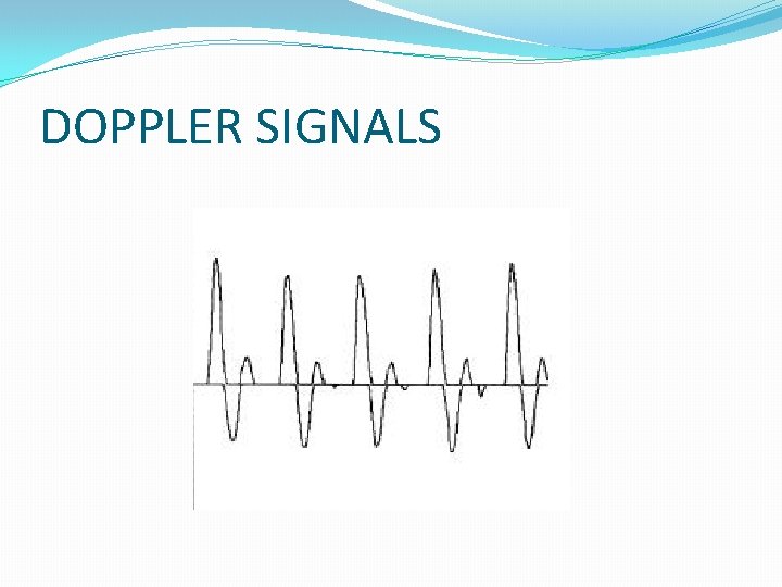 DOPPLER SIGNALS 
