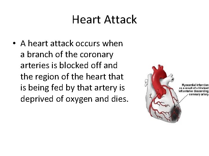 Heart Attack • A heart attack occurs when a branch of the coronary arteries