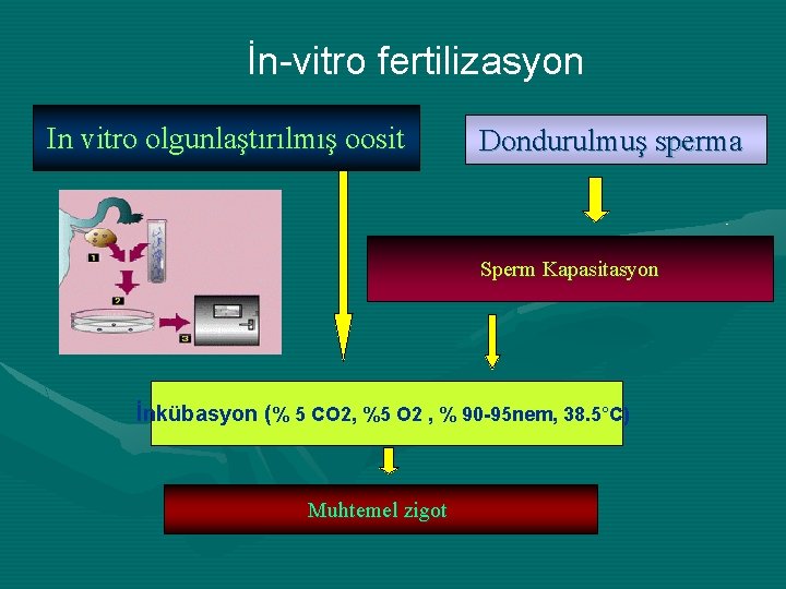 İn-vitro fertilizasyon In vitro olgunlaştırılmış oosit Dondurulmuş sperma Sperm Kapasitasyon İnkübasyon (% 5 CO