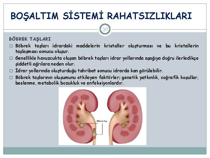 BOŞALTIM SİSTEMİ RAHATSIZLIKLARI 30 BÖBREK TAŞLARI � Böbrek taşları idrardaki maddelerin kristaller oluşturması ve