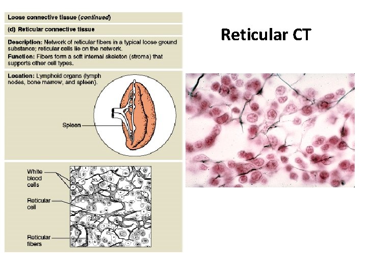 Reticular CT 