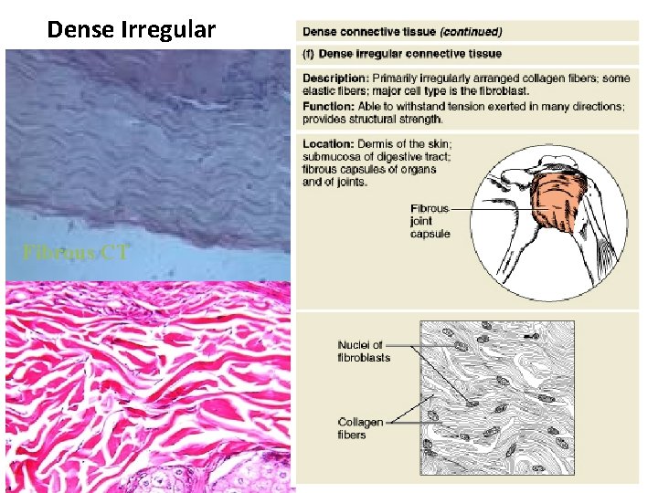 Dense Irregular Fibrous CT Figure 4. 8 f 