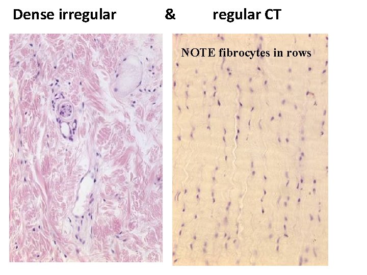 Dense irregular & regular CT NOTE fibrocytes in rows 