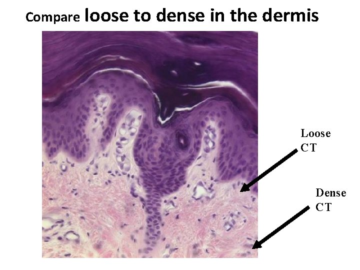 Compare loose to dense in the dermis Loose CT Dense CT 