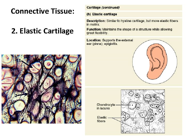 Connective Tissue: 2. Elastic Cartilage Figure 4. 8 h 