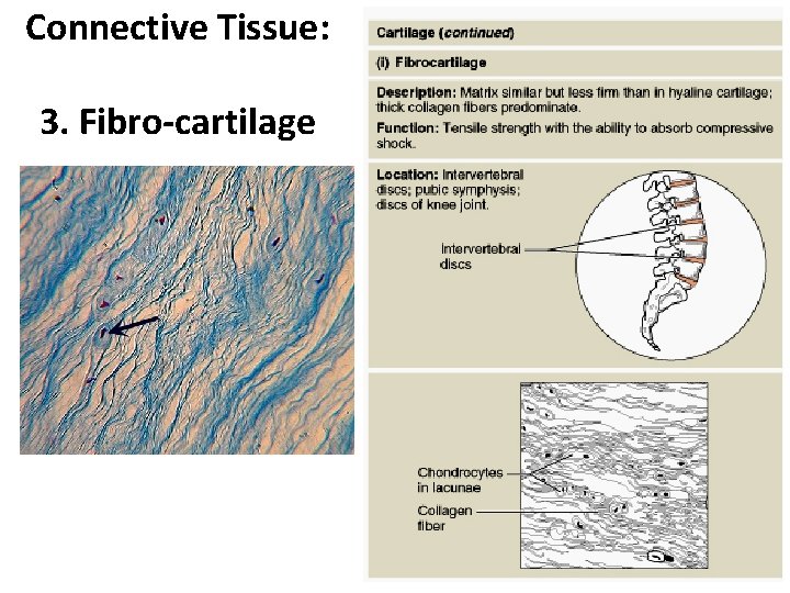 Connective Tissue: 3. Fibro-cartilage Figure 4. 8 i 