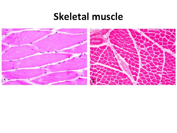 Skeletal muscle 