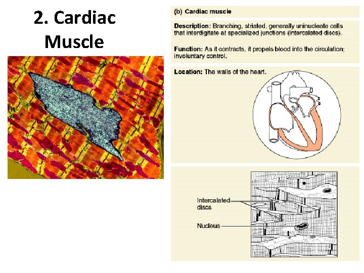 2. Cardiac Muscle Figure 4. 11 b 