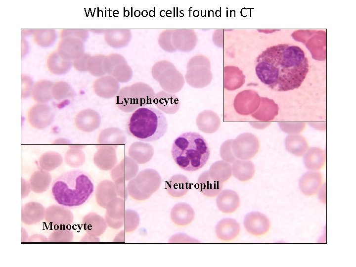 White blood cells found in CT Lymphocyte Eosinophil Neutrophil Monocyte 