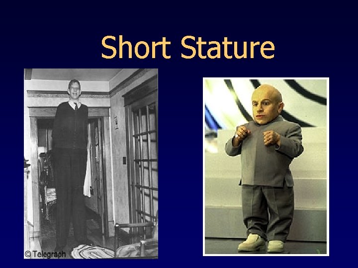 Short Stature 