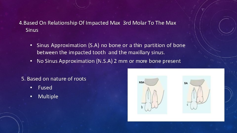 4. Based On Relationship Of Impacted Max 3 rd Molar To The Max Sinus