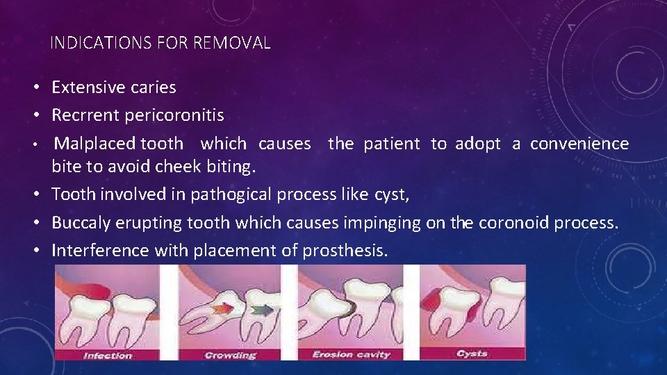 INDICATIONS FOR REMOVAL • Extensive caries • Recrrent pericoronitis • Malplaced tooth which causes