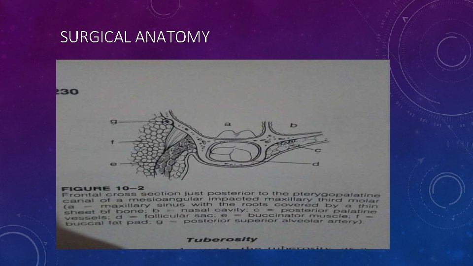 SURGICAL ANATOMY 