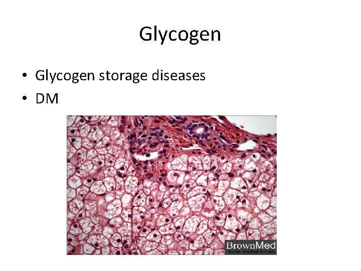 Glycogen • Glycogen storage diseases • DM 