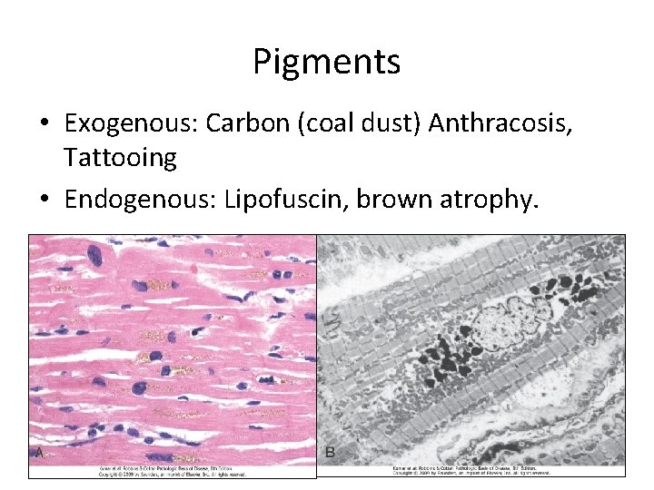 Pigments • Exogenous: Carbon (coal dust) Anthracosis, Tattooing • Endogenous: Lipofuscin, brown atrophy. 