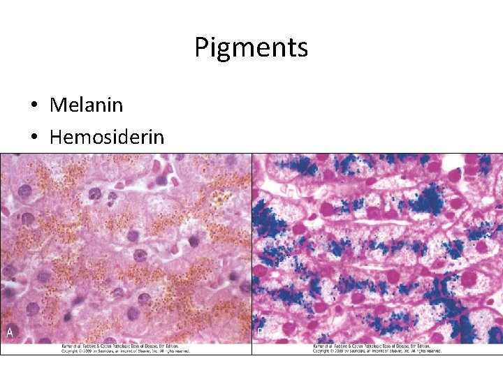 Pigments • Melanin • Hemosiderin 