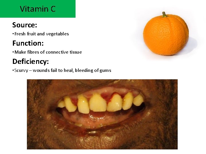 Vitamin C Source: • Fresh fruit and vegetables Function: • Make fibres of connective