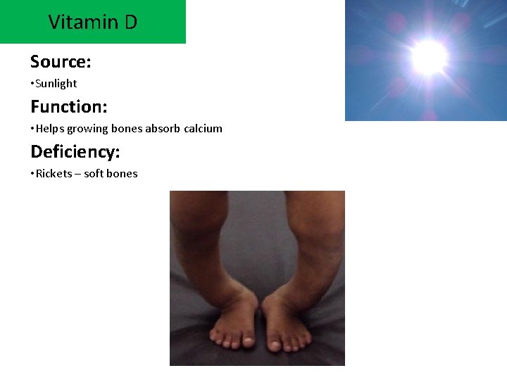 Vitamin D Source: • Sunlight Function: • Helps growing bones absorb calcium Deficiency: •