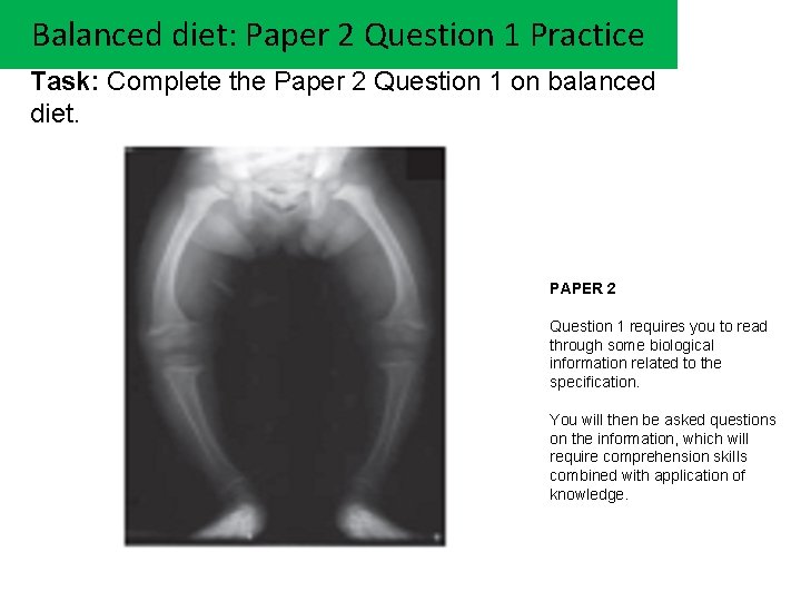 Balanced diet: Paper 2 Question 1 Practice Task: Complete the Paper 2 Question 1