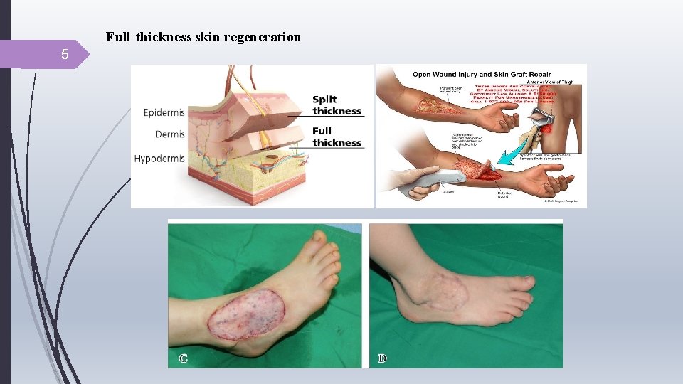 Full-thickness skin regeneration 5 