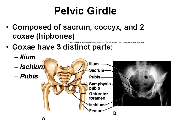 Pelvic Girdle • Composed of sacrum, coccyx, and 2 coxae (hipbones) • Coxae have