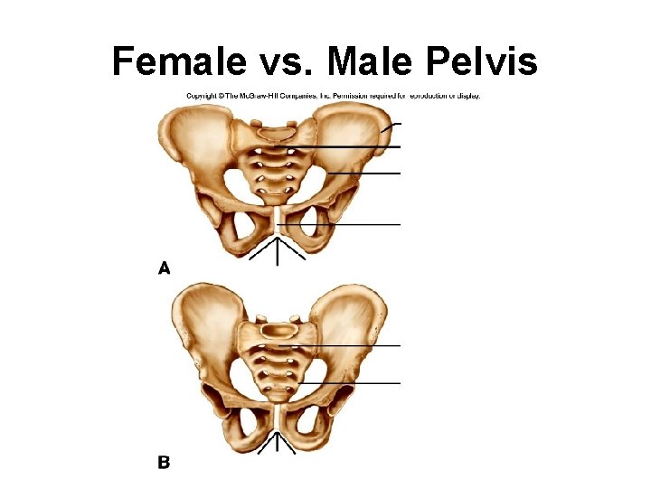 Female vs. Male Pelvis 