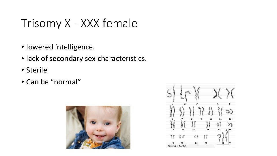 Trisomy X - XXX female • lowered intelligence. • lack of secondary sex characteristics. Trisomy X - XXX female • lowered intelligence. • lack of secondary sex characteristics.