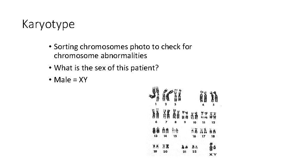 Karyotype • Sorting chromosomes photo to check for chromosome abnormalities • What is the Karyotype • Sorting chromosomes photo to check for chromosome abnormalities • What is the